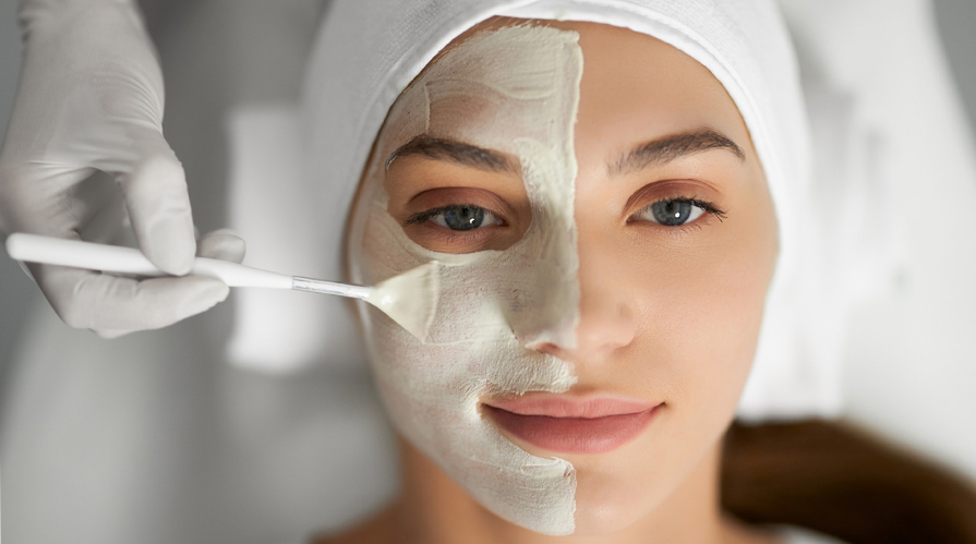 Chemical Peel Treatment